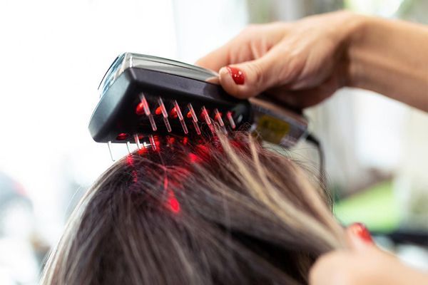 Tricóloga aplica tratamiento con luz láser para frenar el adelgazamiento del pelo en paciente femenina