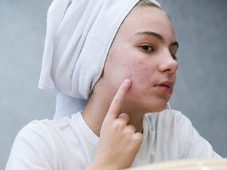 Mejores clínicas de tratamiento para el acné en CDMX - Joven con granos y espinillas examina su rostro frente al espejo