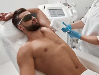 Hombre recibe tratamiento con luz pulsada intensa para deshacerse del vello de las axilas
