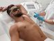 Hombre recibe tratamiento con luz pulsada intensa para deshacerse del vello de las axilas