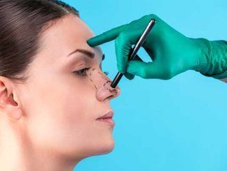 Las 10 mejores clínicas de rinoplastia en CDMX - cirujano plástico dibujando el diseño de la rinoplastia en la nariz de una paciente