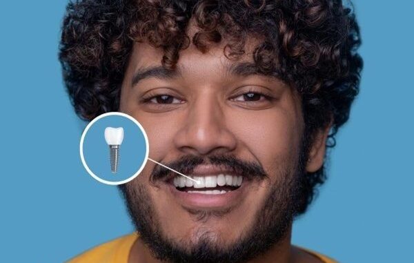 Mejores clínicas en implantes dentales - Hombre con una sonrisa gracias a la colocación de un implante dental en las mejores clínicas de implantes dentales en CDMX