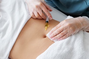 Carboxiterapia de los mejores tratamientos estéticos no quirúrgicos en CDMX