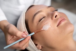 Peeling químico de los mejores tratamientos estéticos no quirúrgicos en CDMX