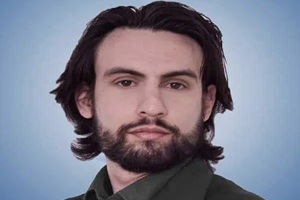 Doctores de injerto de cabello en CDMX - Dr. Diego Valadéz