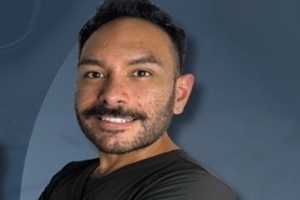 Doctores de injerto de cabello en CDMX - Dr. Luis Gabriel Esquivel