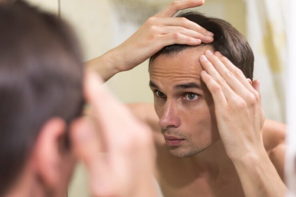Soluciones a la calvicie - Hombre revisa sus entradas con alopecia antes de decidirse por un injerto de cabello CDMX