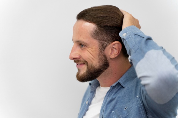 Trasplante de cabello - Hombre feliz con su cabello abundante y natural luego de un injerto de cabello CDMX