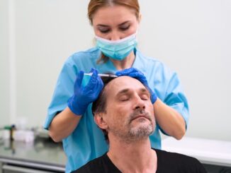 Tratamiento PRP - Médico tricólogo realizando un tratamiento plasma rico en plaquetas a un hombre para fortalecer el injerto de cabello CDMX