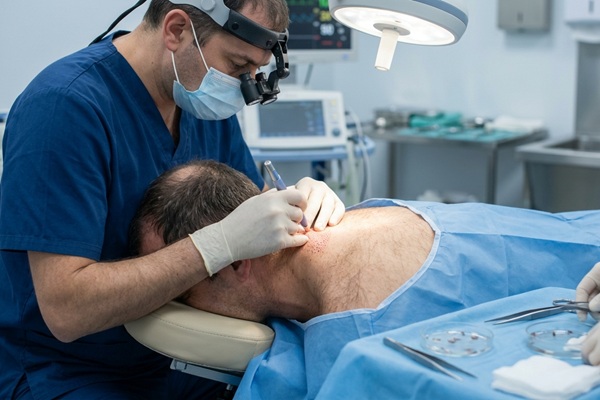 Médico tricólogo extrayendo folículos del vello corporal para realizar un implante con la técnica BHT